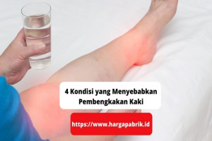 4 Kondisi yang Menyebabkan Pembengkakan Kaki