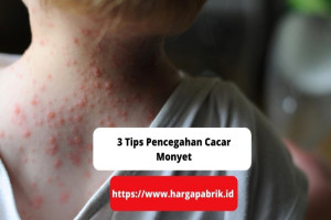 3 Tips Pencegahan Cacar Monyet