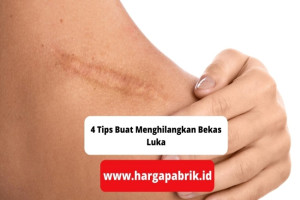 4 Tips Buat Menghilangkan Bekas Luka