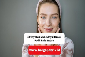 4 Penyebab Munculnya Bercak Putih Pada Wajah