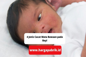 4 Jenis Cacat Mata Bawaan pada Bayi