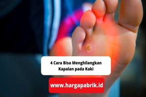 4 Cara Bisa Menghilangkan Kapalan pada Kaki