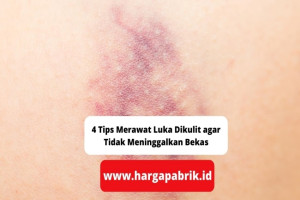 4 Tips Merawat Luka Dikulit agar Tidak Meninggalkan Bekas