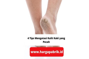 4 Tips Mengatasi Kulit Kaki yang Pecah