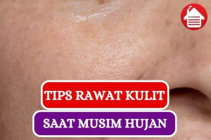 10 Tips Rawat Kulit saat Musim Hujan