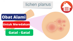 6 Obat Alami Yang Ampuh Meredakan Gatal