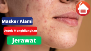 5 Masker Dari Alam Untuk Meghilangkan Jerawat