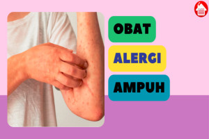 10 Rekomendasi Obat Alergi Terbaik, Bantu Redakan Alergi