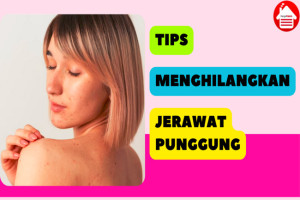 7 Tips Menghilangkan Jerawat Punggung yang Praktis dan Ampuh