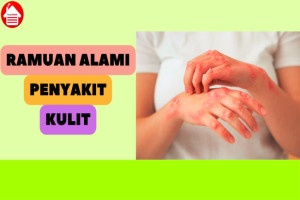 7 Ramuan Alami untuk Sembuhkan Penyakit Kulit