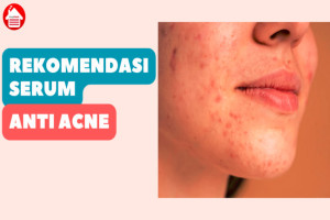 5 Rekomendasi Serum Anti Acne Terbaik: Buat Kulit Glowing