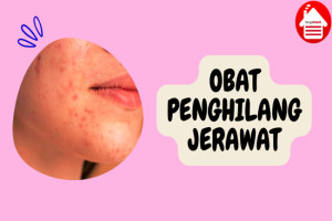 6 Jenis Obat Penghilang Jerawat untuk Kulit yang Lebih Sehat