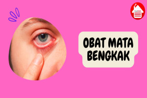 4 Pilihan Obat Mata Bengkak yang Sesuai dengan Penyebabnya