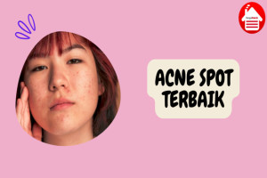 10 Rekomendasi Acne Spot Terbaik untuk Kulit Bebas Jerawat