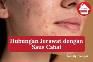 4  Hubungan Jerawat dengan Saus Cabai