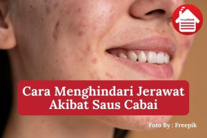 4 Cara Menghindari Jerawat Akibat Konsumsi Saus Cabai