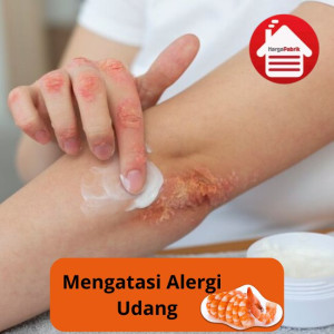 Mengatasi Alergi Udang Dan Cara Penanganannya