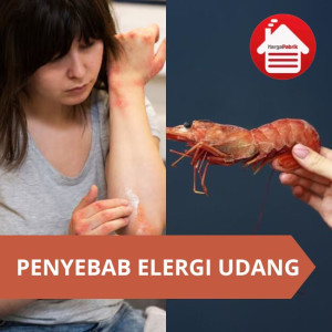 Alergi Udang: Penyebab, Gejala, dan Pengelolaannya